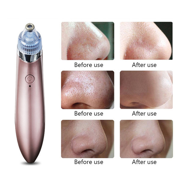 2177107237_vakuumnyj-apparat-dlya Вакуумний апарат для чищення пор Beauty Skin Care Specialist XN-8030 - Зображення 5