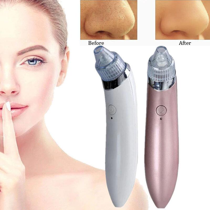 2177107240_vakuumnyj-apparat-dlya Вакуумний апарат для чищення пор Beauty Skin Care Specialist XN-8030 - Зображення 1