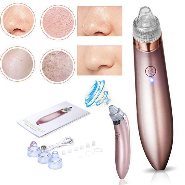 2177107242_vakuumnyj-apparat-dlya Вакуумний апарат для чищення пор Beauty Skin Care Specialist XN-8030 - Зображення 2